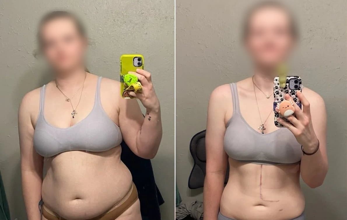 Patient transformation